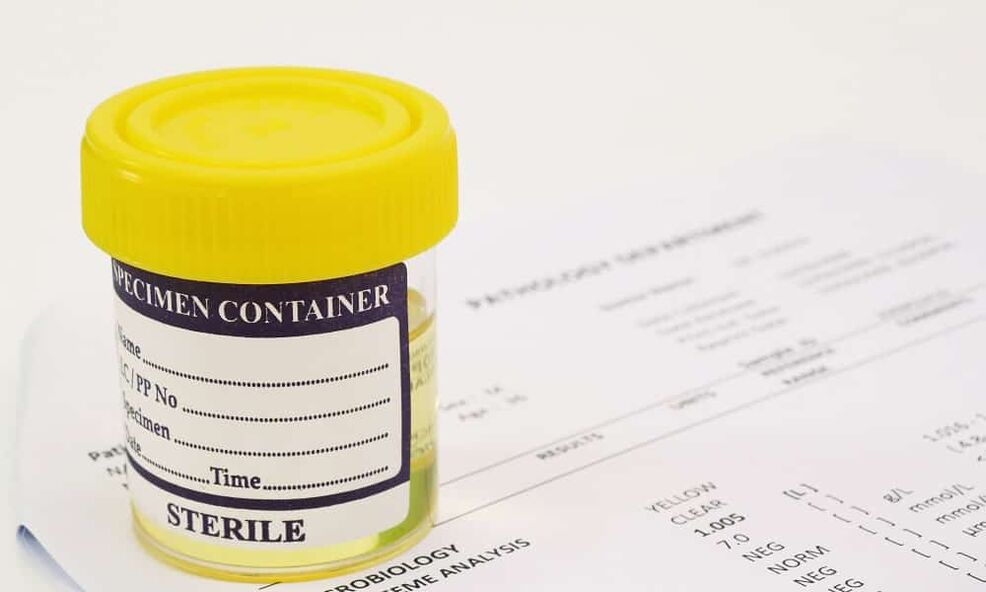 Prieš pradėdami vartoti antibiotikus, turite atlikti šlapimo tyrimą